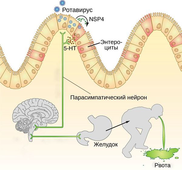 Механизм возникновения рвоты
