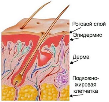 дерма