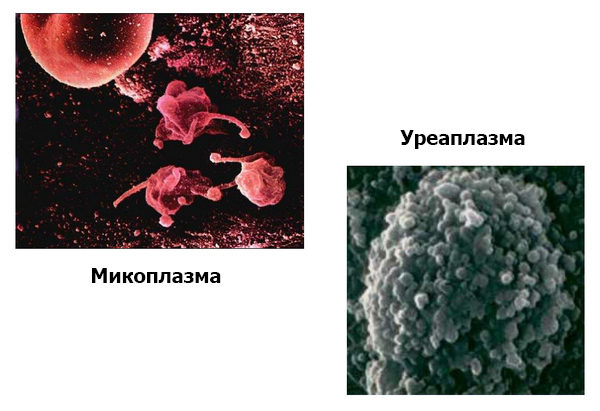 Уреаплазма и микоплазма