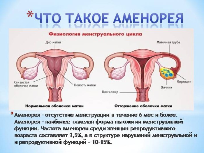 Дюфастон, чтобы вызвать месячные. Инструкция применения, противопоказания