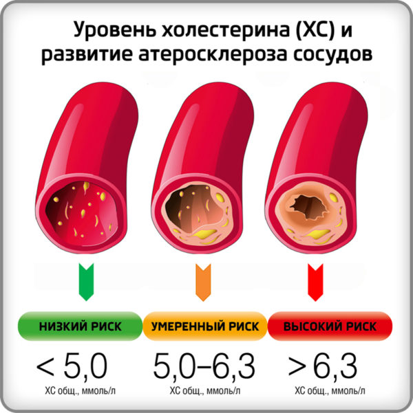 Сколько лет могут быть приливы при климаксе