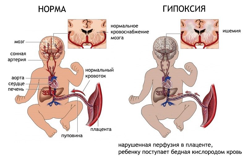 Опасность заболевания для ребенка