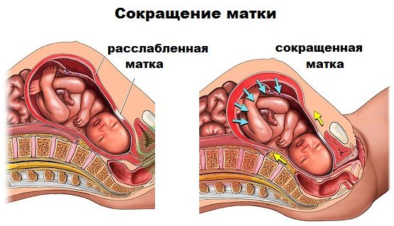 Сокращение матки