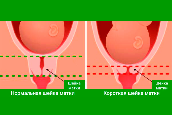 Как часто делают и на каком сроке?