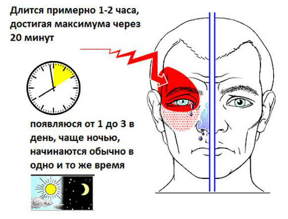 головные боли при беременности