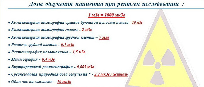 можно ли беременным делать флюорографию