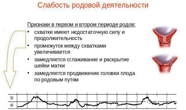 как понять как начинаются схватки