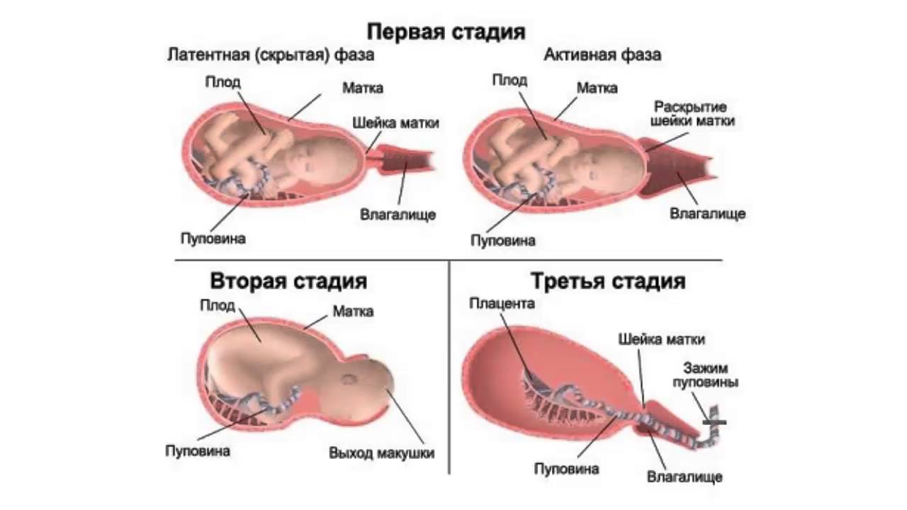 как понять как начинаются схватки