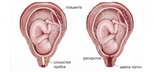 Отхождение слизистой пробки