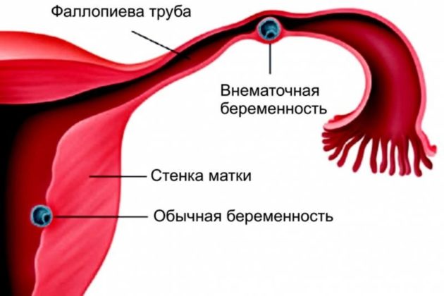 Мажущие выделения в середине цикла