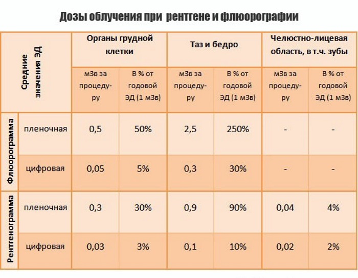 Флюорография во время беременности на ранних сроках, 3 триместр. Последствия для ребенка