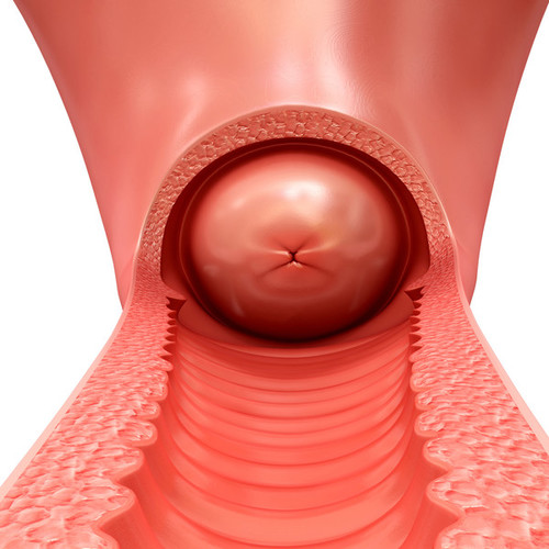 Шейка матки. Фото внутри, строение, норма размеров здоровой при беременности, перед родами, месячными