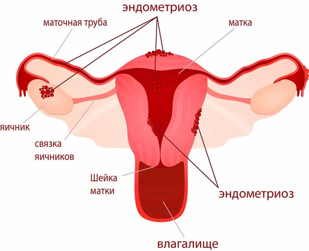 Шейка матки. Фото внутри, строение, норма размеров здоровой при беременности, перед родами, месячными