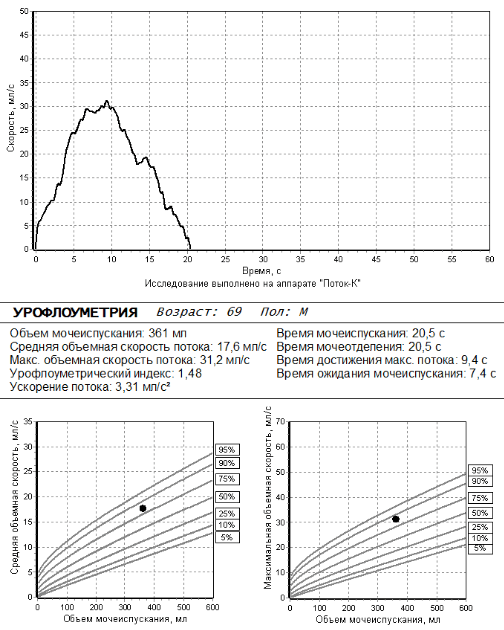 Пример результатов урофлоуметрии у мужчины 69 лет 