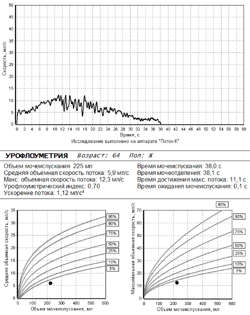 Результат урофлоурографии у мужчины 64 лет 