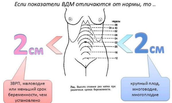 ВДМ при беременности по неделям. Таблица, что это такое, расшифровка, норма