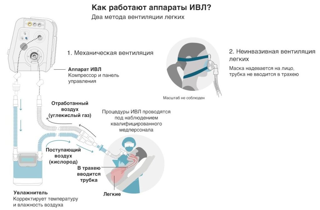 вентиляция легких