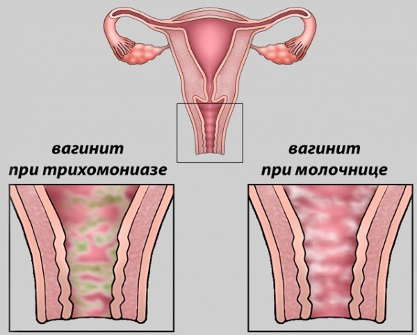 Цервикальная слизь. Что это при овуляции и после, перед месячными, нормы по дням цикла