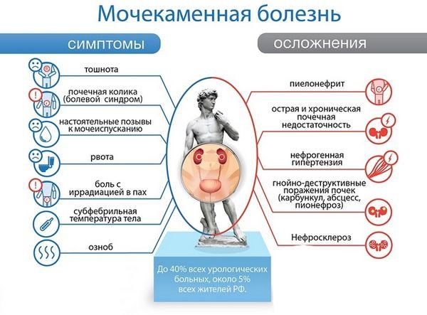 Симптомы и осложнения мочекаменной болезни